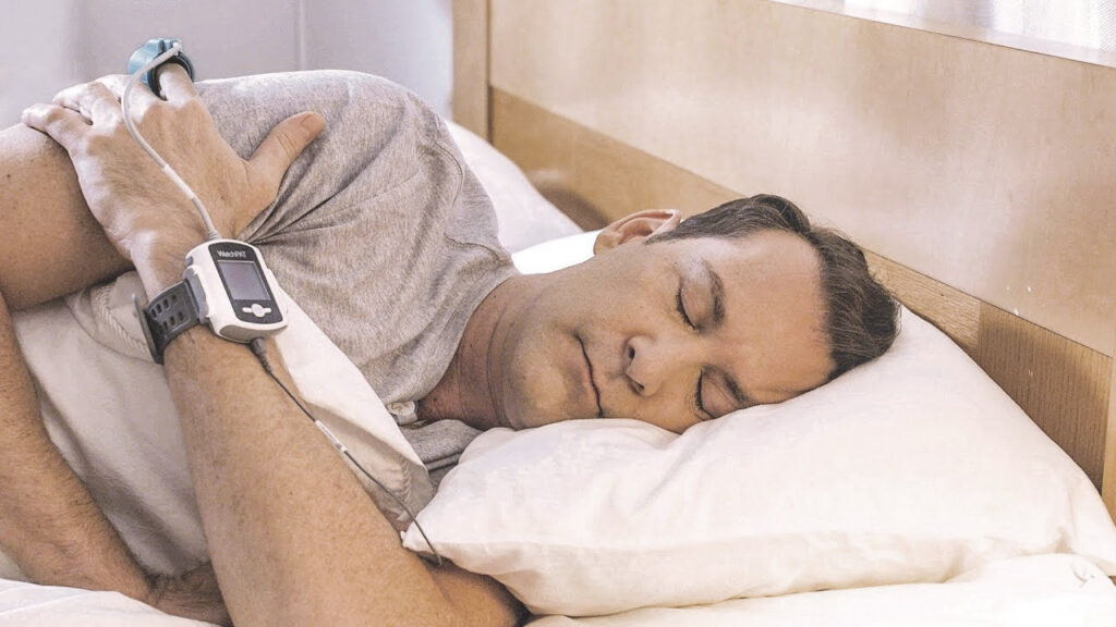 Sleep Apnea